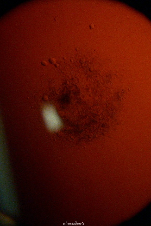 cataracte sous-capsulaire postérieure