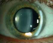 ligilo al oftalmologia fotaro